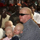 Image for article titled Killers Jailed for Murdering Burundi Albinos, Selling Body Parts
